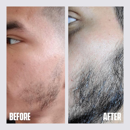 Dr. Alies Professional Beard Growth Oil | Natural Formula with Vitamin E, Almond Oil & Castor Oil | Fills Patchy Areas, Reduces Itch & Strengthens Beard