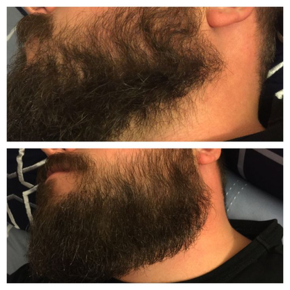 Dr. Alies Professional Beard Growth Oil | Natural Formula with Vitamin E, Almond Oil & Castor Oil | Fills Patchy Areas, Reduces Itch & Strengthens Beard