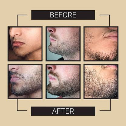 Dr. Alies Professional Beard Growth Oil | Natural Formula with Vitamin E, Almond Oil & Castor Oil | Fills Patchy Areas, Reduces Itch & Strengthens Beard
