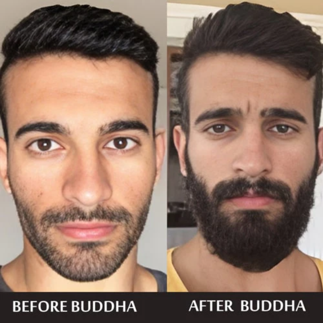 Dr. Alies Professional Beard Growth Oil | Natural Formula with Vitamin E, Almond Oil & Castor Oil | Fills Patchy Areas, Reduces Itch & Strengthens Beard