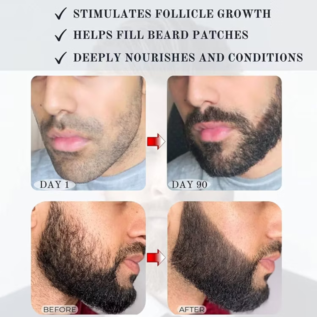 Dr. Alies Professional Beard Growth Oil | Natural Formula with Vitamin E, Almond Oil & Castor Oil | Fills Patchy Areas, Reduces Itch & Strengthens Beard
