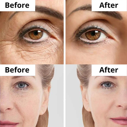 Calcium & Collagen Balm Stick | Removes Wrinkles & Gives Hydration & Glow