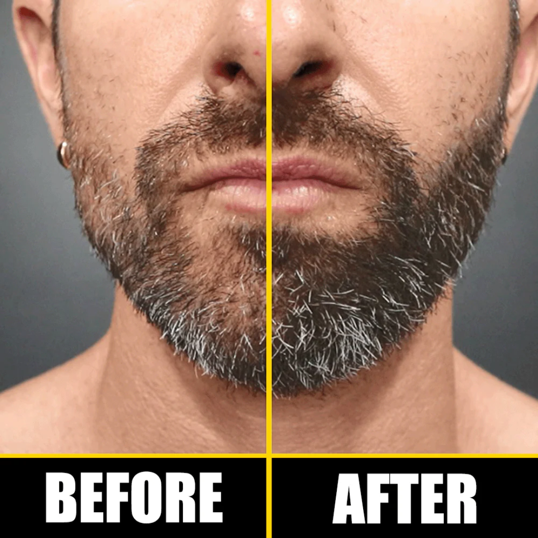Dr. Alies Professional Beard Growth Oil | Natural Formula with Vitamin E, Almond Oil & Castor Oil | Fills Patchy Areas, Reduces Itch & Strengthens Beard