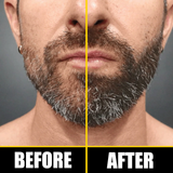 Dr. Alies Professional Beard Growth Oil | Natural Formula with Vitamin E, Almond Oil & Castor Oil | Fills Patchy Areas, Reduces Itch & Strengthens Beard