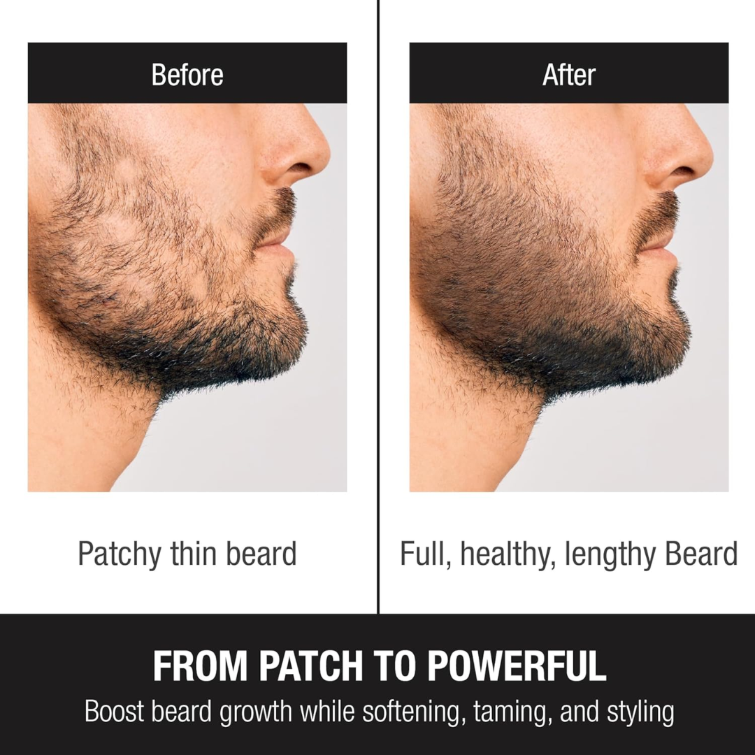 Dr. Alies Professional Beard Growth Oil | Natural Formula with Vitamin E, Almond Oil & Castor Oil | Fills Patchy Areas, Reduces Itch & Strengthens Beard