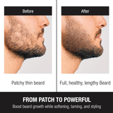 Dr. Alies Professional Beard Growth Oil | Natural Formula with Vitamin E, Almond Oil & Castor Oil | Fills Patchy Areas, Reduces Itch & Strengthens Beard