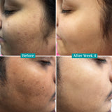 10% Vitamin C Face Serum For Triple Glow+++