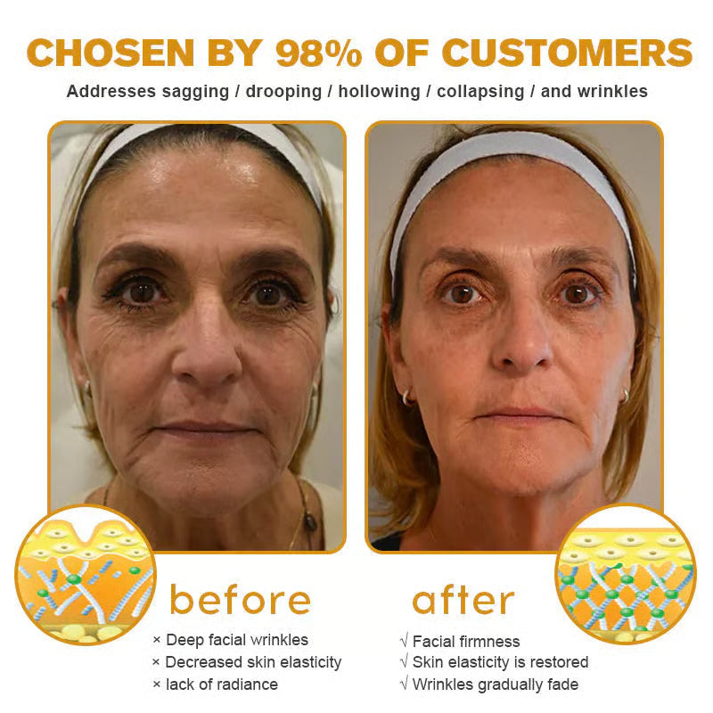 👨‍⚕️Botox Bee Venom Wrinkle Removal Cream