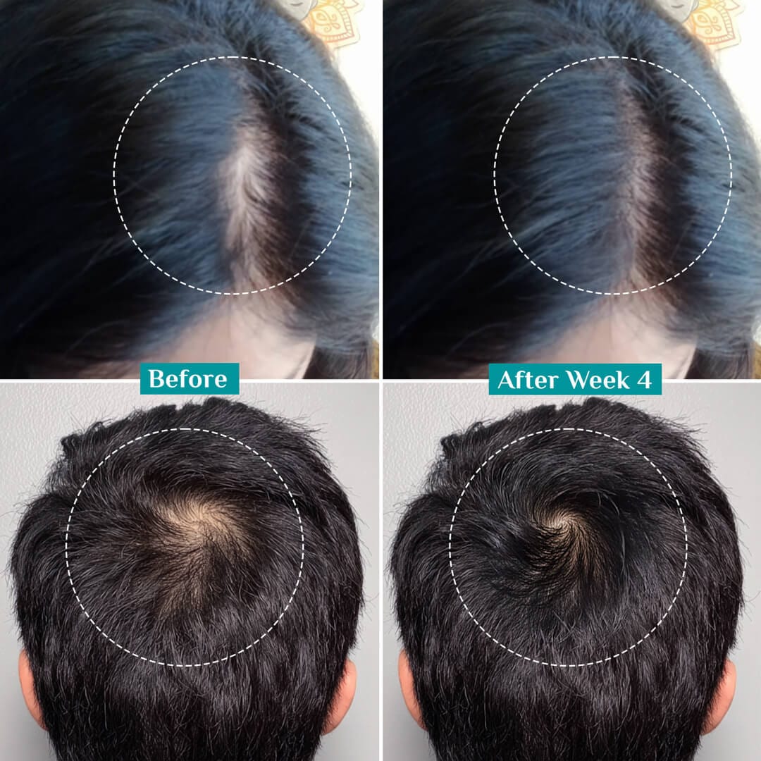 3% Redensyl, 4% Anagain & 5% Capilia Stem Cell Complex Advanced Hair Growth Serum