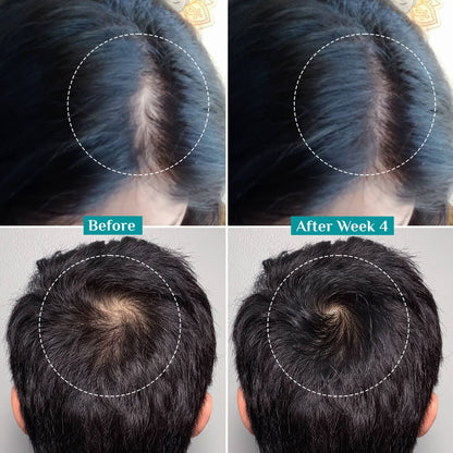 3% Redensyl, 4% Anagain & 5% Capilia Stem Cell Complex Advanced Hair Growth Serum