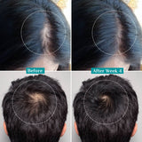 3% Redensyl, 4% Anagain & 5% Capilia Stem Cell Complex Advanced Hair Growth Serum