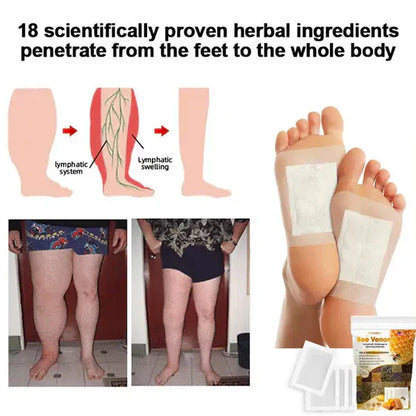 Bee Venom Foot Patches (Set of 10 Patches)