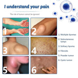 LIPOMA REMOVAL SPRAY (IMPORTED)